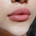 مطب زیبایی دکتر حیدری