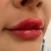 کلینیک زیبایی درمیس
