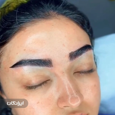 کارشناس کاشت مو شیما اوجی