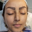 کارشناس کاشت مو شیما اوجی