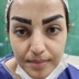 کارشناس کاشت مو شیما اوجی