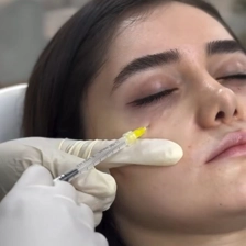 کلینیک زیبایی درموهیل