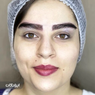 کلینیک زیبایی آدینا