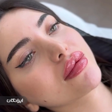 کلینیک زیبایی مهوین