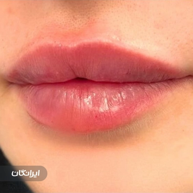 کلینیک زیبایی پاترا