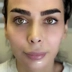 کلینیک زیبایی هانیسا