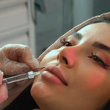 کلینیک زیبایی هورسام
