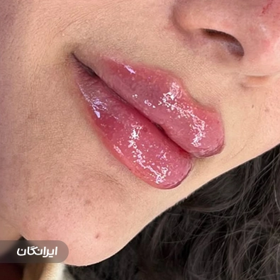 کلینیک زیبایی دکتر زکیه تفت