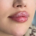 کلینیک زیبایی دکتر مهسا محمدی