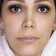 کلینیک زیبایی دنیز