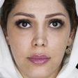 کلینیک زیبایی دنیز