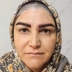 کلینیک کاشت مو کرمی پور