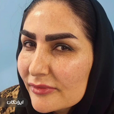 کلینیک کاشت مو کرمی پور