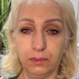 کلینیک زیبایی آویسا
