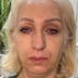 کلینیک زیبایی آویسا