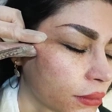 کلینیک زیبایی باران