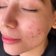 مرکز خدمات پوستی نرگس