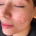 مرکز خدمات پوستی نرگس