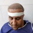 کلینیک کاشت مو مرادی