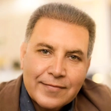 کلینیک کاشت مو مرادی