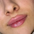 کلینیک زیبایی دکتر سینا ملاشاهی