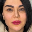 کلینیک زیبایی دکتر شایان اشرفی