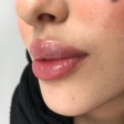 کلینیک زیبایی دکتر مهشید آقازاده