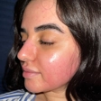 سالن مراقبت پوستی دنیز