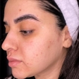 سالن مراقبت پوستی دنیز