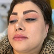 کلینیک زیبایی و لاغری باران
