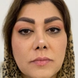 کلینیک زیبایی و لاغری باران