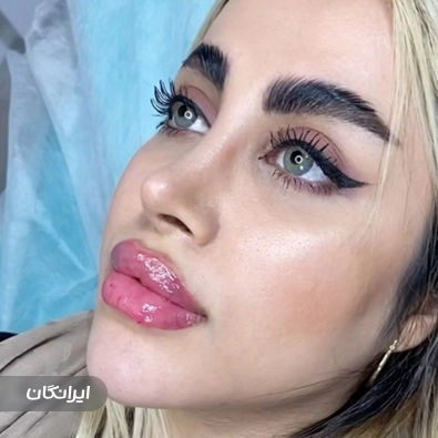 کلینیک زیبایی گلین