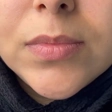 کلینیک زیبایی دلی هرمون