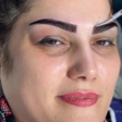 کارشناس کاشت مو فائزه نظامیوند