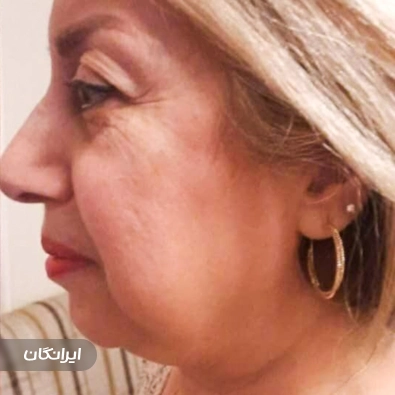 کلینیک زیبایی مایا