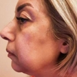 کلینیک زیبایی مایا