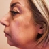 کلینیک زیبایی مایا