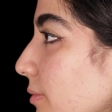 دکتر فرهاد نوژن