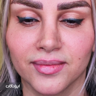 کلینیک زیبایی دکتر فروغ حسینی