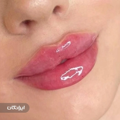 کلینیک زیبایی نسیم
