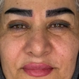 کارشناس کاشت مو شادی حسینی