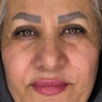 کارشناس کاشت مو شادی حسینی