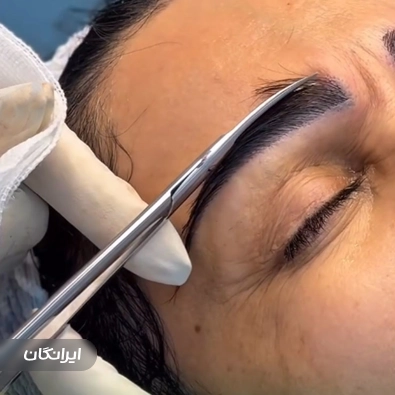کارشناس کاشت مو شادی حسینی
