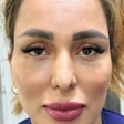 کارشناس کاشت مو شبنم رشیدی