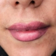 کلینیک زیبایی رویال