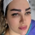 کارشناس کاشت مو مینا قاسمی