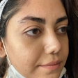 کلینیک زیبایی نیولایف