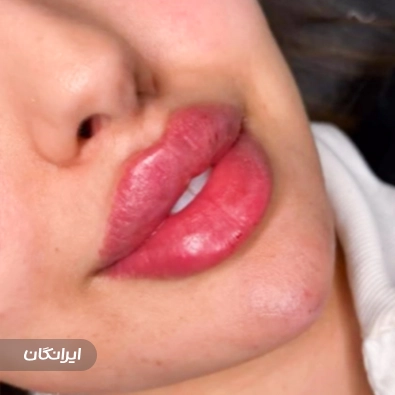 کلینیک سمیرا بیوتی