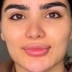 کلینیک زیبایی مهرآرا
