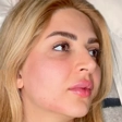 کلینیک زیبایی دکتر رامين يحيوى
